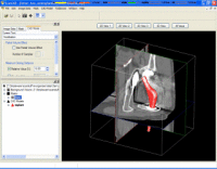 +ScanCAD interface
